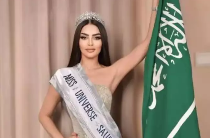 Saudi's First Miss Universe contestant, Rumy Alqahtani, is a Certified Dentist!(30828)