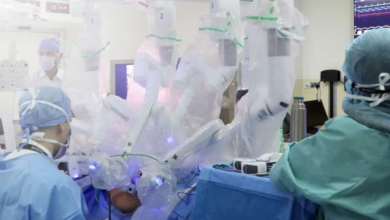 UAE performs first simultaneous robotic kidney transplant for donor and recipien